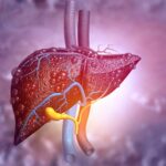 Fatty Liver Disease, A Diabetes Complication, Deserves More Attention